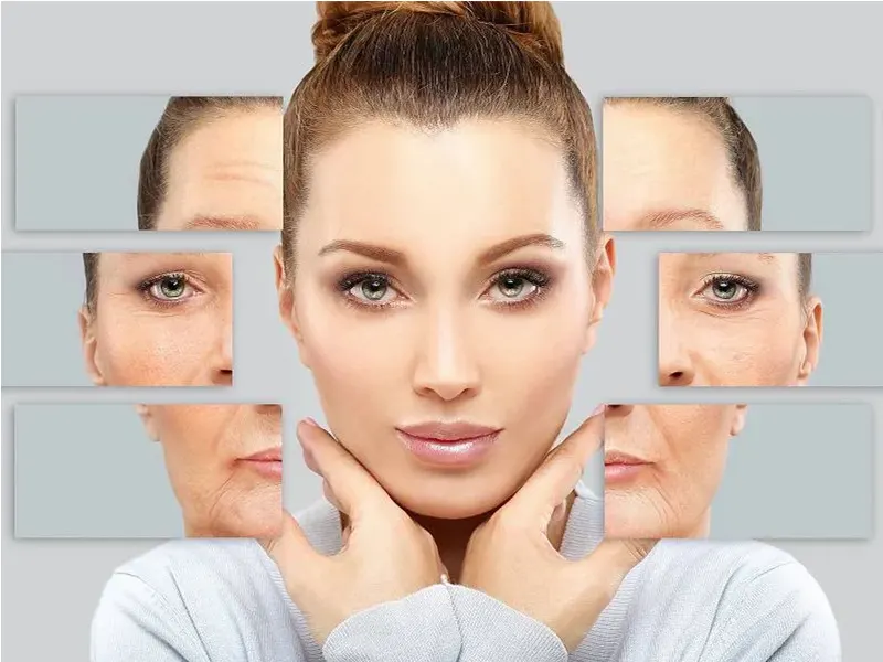 لیفت صورت و جراحی زیبایی توسط دکتر رضا امیرزرگر فوق تخصص جراحی زیبایی
