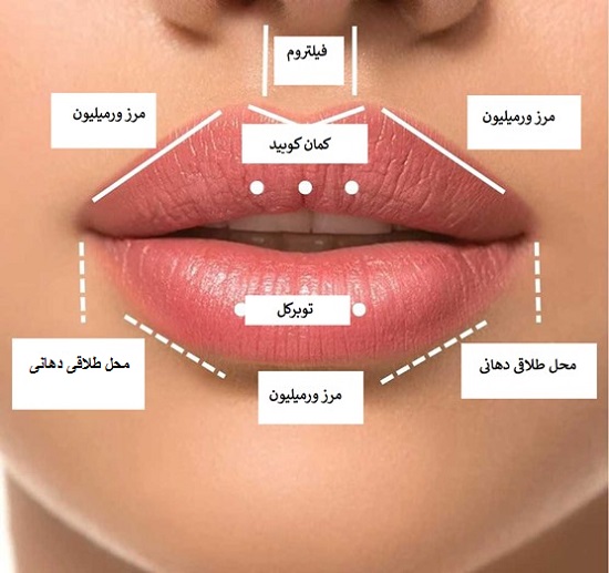 تزریق ژل و مراقبت عای بعد از آن توسط دکتر رضا امیرزرگر فوق تخصص جراحی زیبایی صورت فک دهان دندان