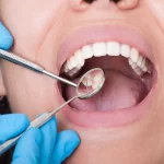 بیماری دهان و دندان ؛ علت ها و پیشگیری آنها