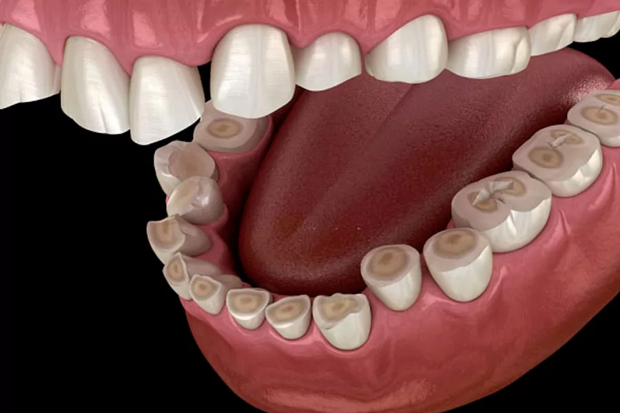 ارتودنسی بیماری های دندان و درمان توسط دکتر رضا امیرزرگر