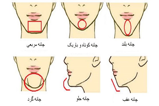 چال چانه و جراحی زیبایی توسط دکتر رضا امیرزرگر فوق تخصص جراحی زیبایی