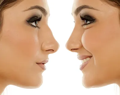 جراحی زیبایی توسط دکتر رضا امیرزرگر فوق تخصص جراحی زیبایی صورت دهان و فک و دندان