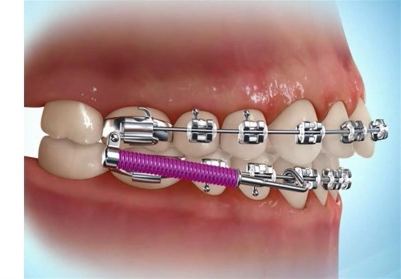 ارتودنسی و جراحی زیبایی توسط دکتر رضاامیرزرگر فوق تخصص جراحی زیبایی فک دهان و دندان