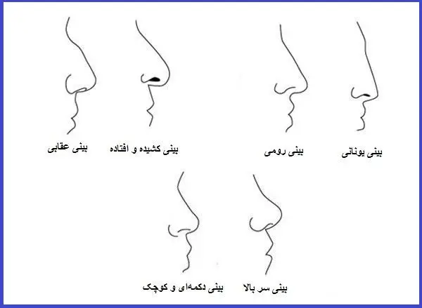 انواع بینی و جراحی بینی توسط دکتر رضا امیرزرگر فوق تخصص جراحی زیبایی صورت فک دهان دندان