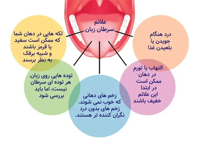 علائم سرطان دهان زبان تومور و کیست های دهانی و درمان توسط دکتر رضا امیرزرگر فوق تخصص جراحی زیبایی صورت فک دهان دندان