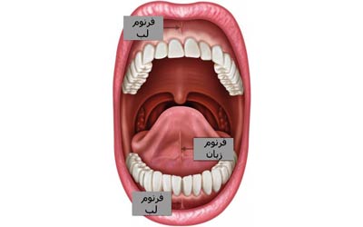 فرنوم لب و درمان توسط دکتر رضا امیرزرگر فوق تخصص جراحی زیبایی صورت فک دهان دندان